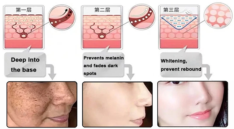 retinol powder Whitening retinol powder Whitening